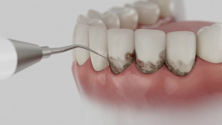 Trusted Tooth Extraction service in Roanoke, VA - Dentist Open Now